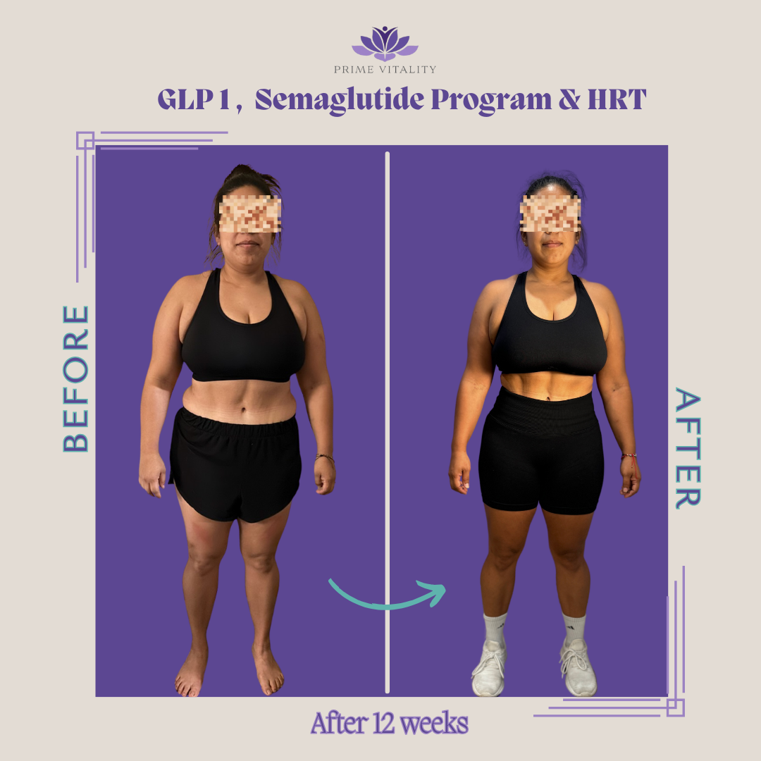 Tirzepatide Weight Loss Transformation