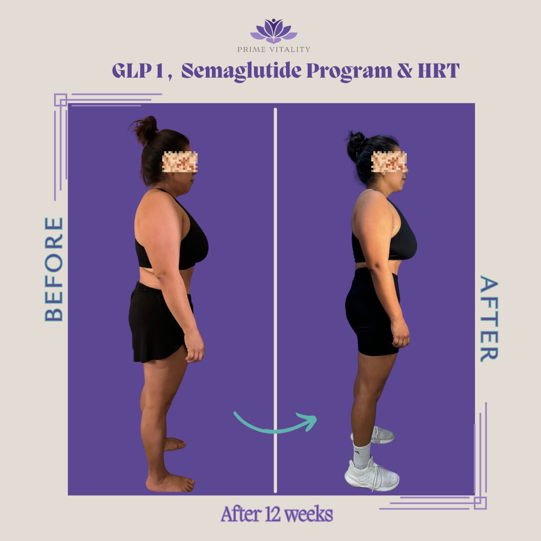 Semaglutide Weight Loss Results - Before and After