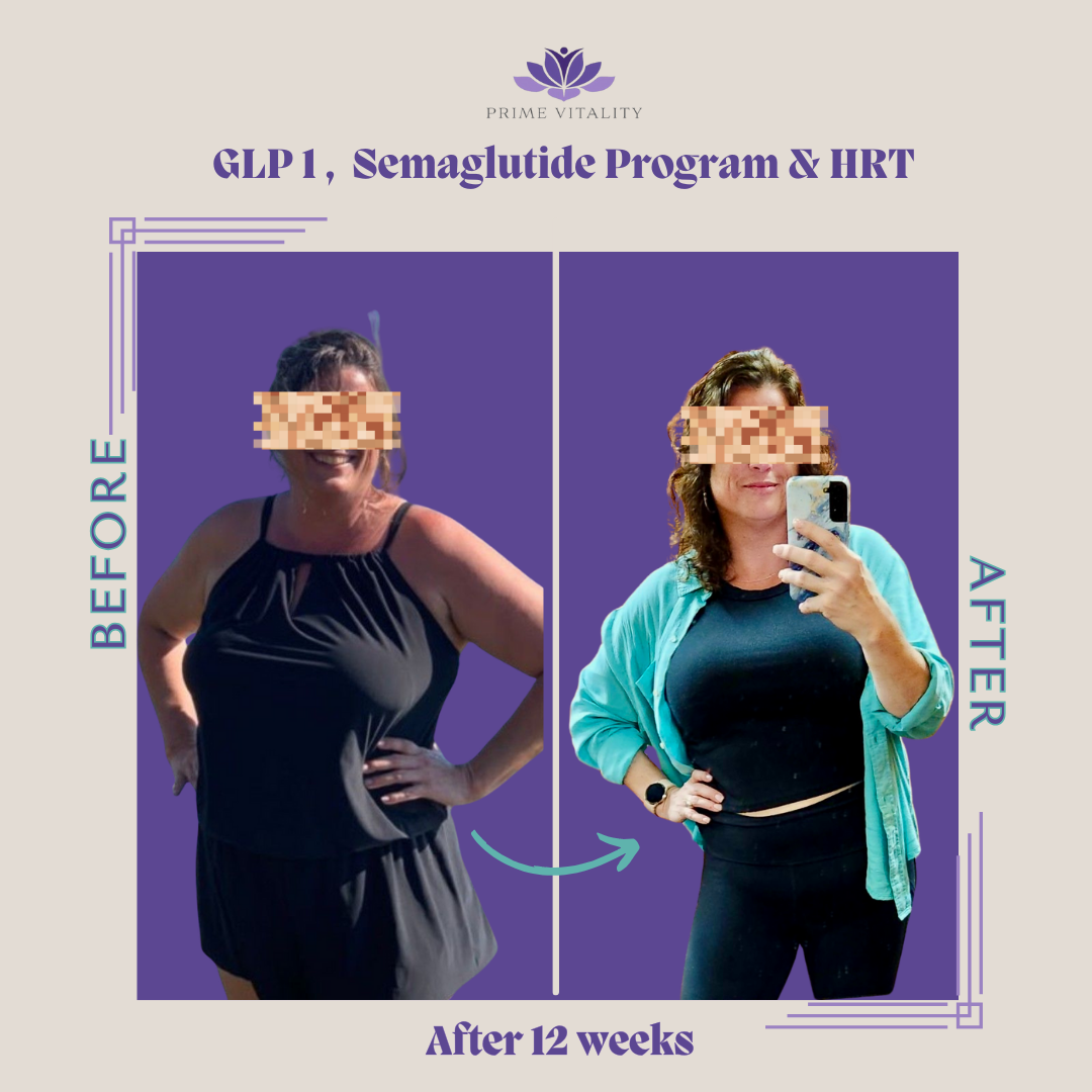 GLP-1 Weight Loss Before After - 12 Week Transformation